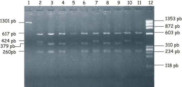 Figura 7. Padrão de fragmentos do produto amplificado do gene  PIT1 digerido com a enzima  Hinf I