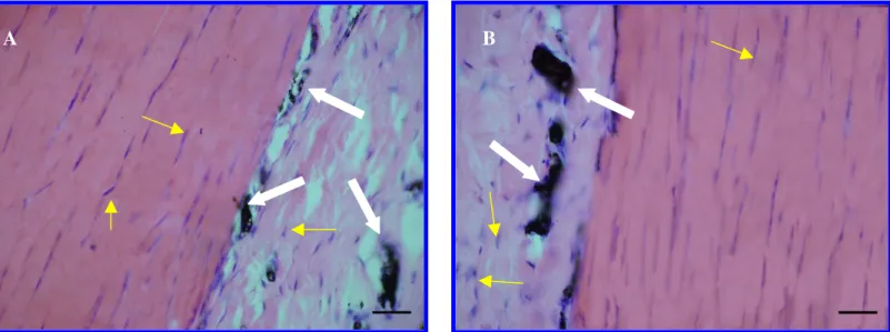 FIGURA 12 A e B: Fotomicrografia do tendão calcâneo normal, sem lesão, mostrando os vasos sangüíneos na região  peritendínea (seta branca) e os fibroblastos ao longo do tendão (seta amarela)