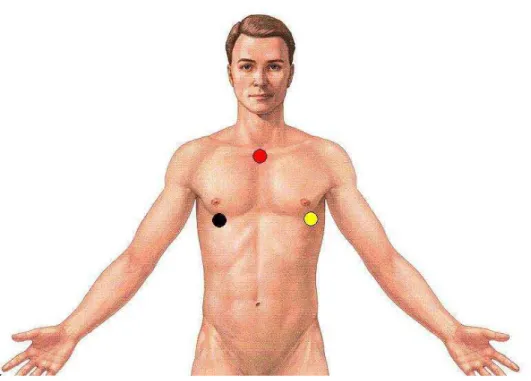 Figura 1. Ilustração do posicionamento dos eletrodos negativo (vermelho), positivo  (amarelo) e neutro (preto) para a captação do eletrocardiograma na  derivação MC5