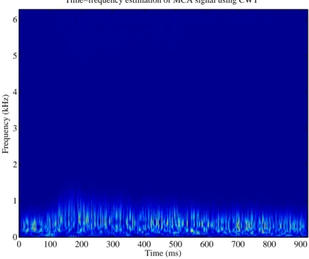 Figure 3.5: Time-frequency representation of MCA blood flow signal without emboli using CWT and a Morlet mother-wavelet function