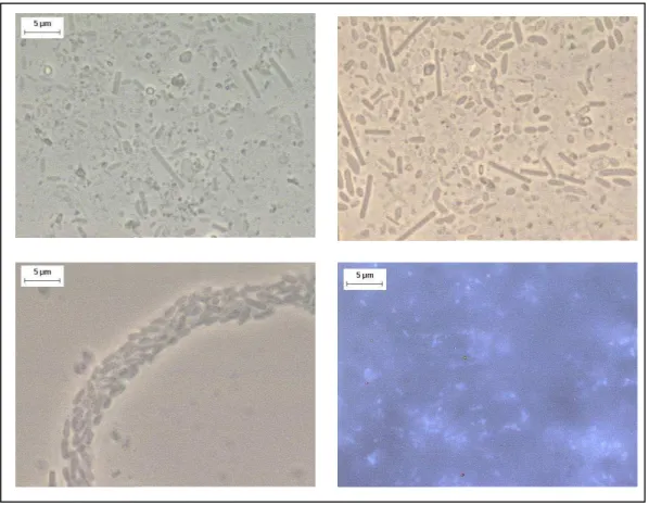 Figura 4.2 Morfologias observadas na adaptação do inóculo: bacilos, víbrios, bacilos  fluorescentes, e morfologias semelhantes a Methanosaeta sp
