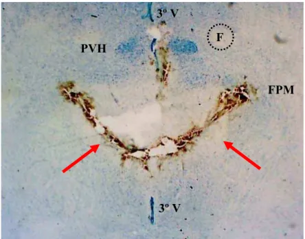 FIGURA 3 : Fotomicrografia de um corte horizontal do prosencéfalo de um rato representativo do  grupo, mostrando a região atingida pela desconexão hipotalâmica caudal (DH-C) ao PVH