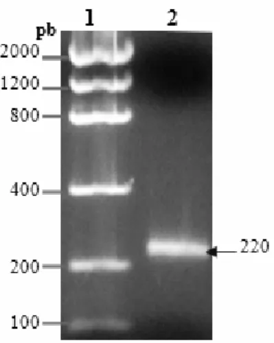 Figura 16: Amplificação de desintegrinas pela RT-PCR. 1) Marcador de baixa massa molecular; 2)  Produto da amplificação utilizando os oligonucleotídeos 5F e 3R (Tabela 10)