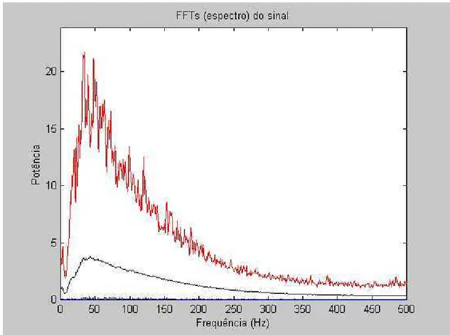 Figura  9. Ilustração  do  espectro  de  potência  do  sinal  eletromiográfico  por meio  da  Transformada Rápida de Fourier (FFT) de um dos voluntários com infarto  antigo do miocárdio(4)