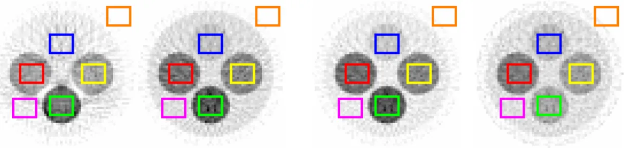FIGURA 5.5 - Janelas de pixels escolhidos como amostras nas imagens com energias de 40, 60, 85 e  662 keV
