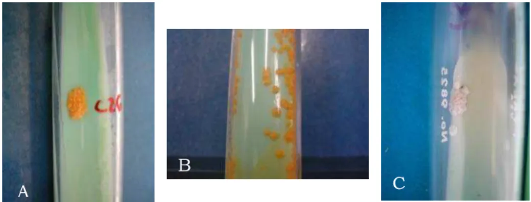 Figura 7 – Colônias de micobactérias em meio L.J. A – colônia rugosa escotocromógena; B –  colônia lisa escotocromógena; C – colônia não cromógena