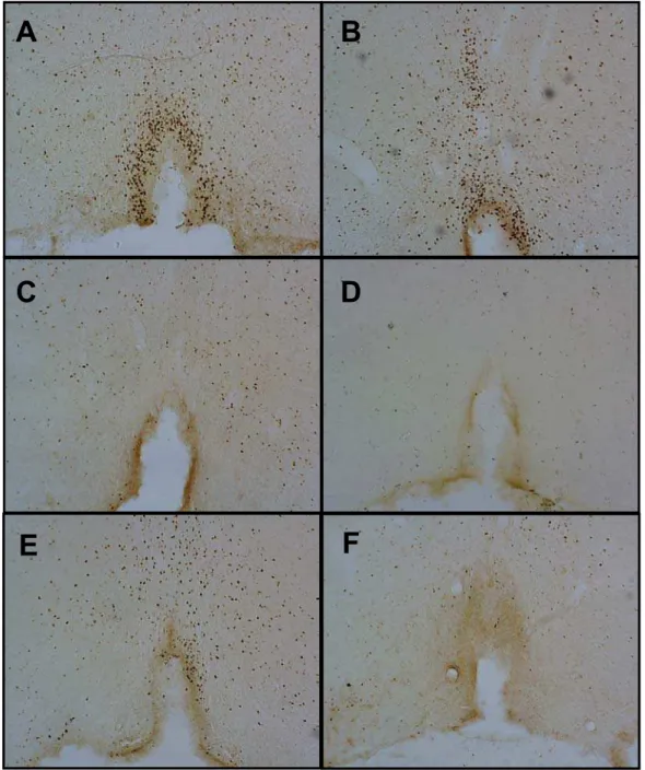 Figura 11: Fotomicrografias (×40) de cortes tranversais do cérebro mostrando as marcações  da imunorreatividade da proteína c-fos no órgão vasculoso da lâmina terminal (OVLT)