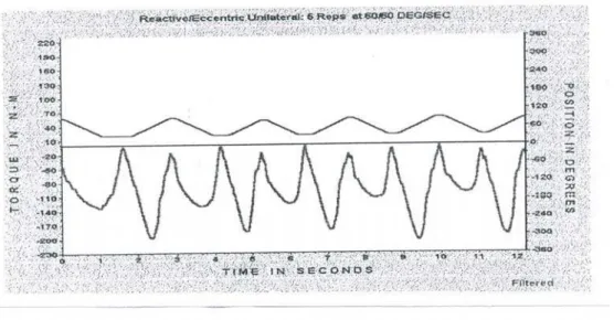 Figura 4.  Ilustração do gráfico de torque fornecido pelo software  do  dinamômetro eletrônico Biodex  após o teste de contração  voluntária máxima excêntrica