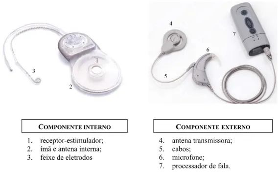 Figura 3. Componentes interno e externo do implante coclear. Dados de Cochear Co. 