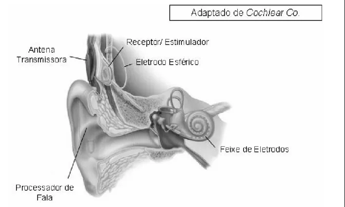 Figura 4. Funcionamento do implante coclear. Dados de Cochear Co. 