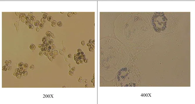 Figura 3.3: Células Sf9 infectadas com Anticarsia gemmatalis (AgMNPV). Identificação de  poliedros nos núcleos celulares a 96 horas pós-infecção