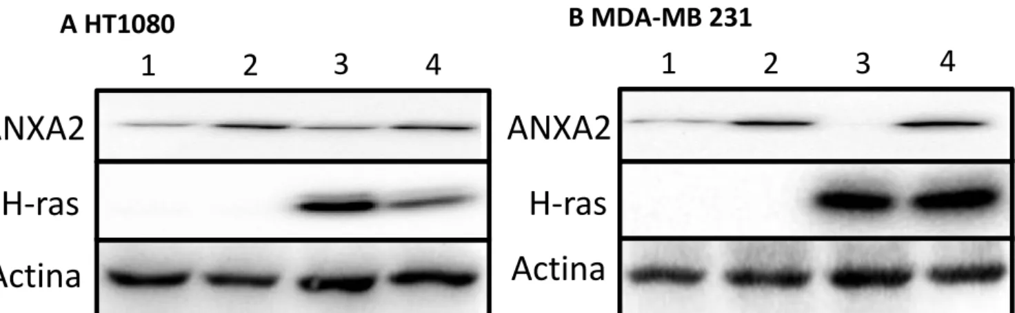 Figura 4.2 – Descrição das linhas celulares, após inserção do shRNA referente à anexina A2 e  respetivo controlo (p36-4 e P36-scramble) e do cDNA referente ao Ras (pBABE e pBABE  H-Ras-v12) - Células HT1080 e MDA-MB 231 foram infetadas primeiramente com so