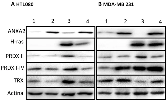 Figura 4.4 – Western blotting para análise das vias de sinalização ativas por Ras - (1- pBABE  p36-4; 2- pBABE p36-scramble; 3- H-ras p36-4; 4- H-ras P36-scramble)
