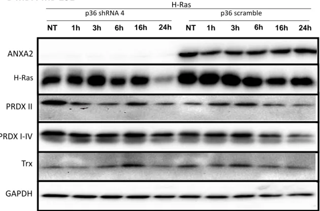 Figura 4.5 - Análise da estabilidade proteica em células HT1080 e MDA-MB 231 submetidas a  tratamento com ciclohexamida – Células HT1080 e MDA MB 231 foram não tratadas (NT) ou  tratadas com 50 µM de CHX por diferentes períodos de tempo como indicado na fi