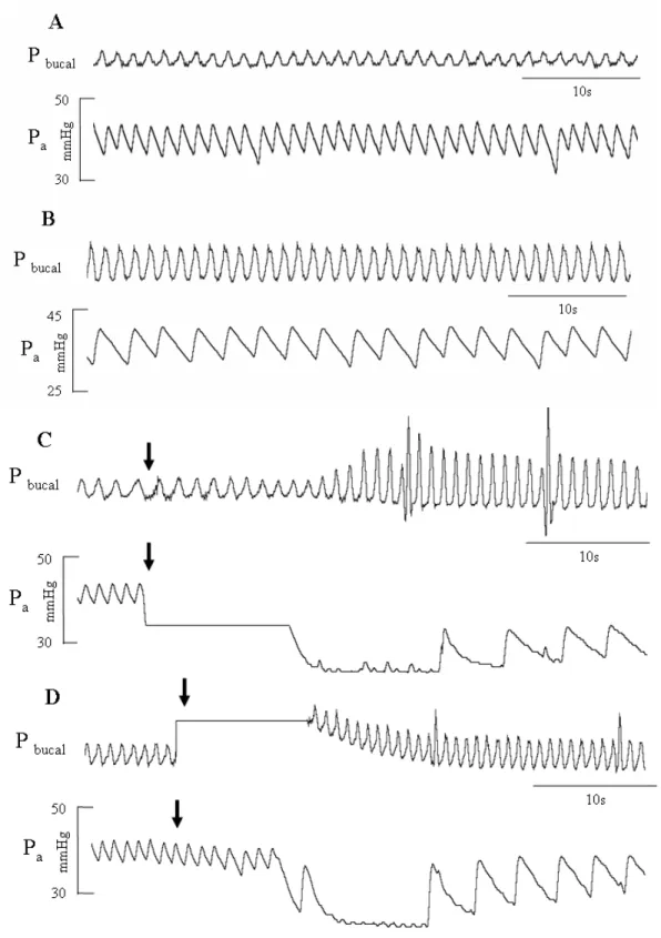 Figura 3: Traçados representativos dos registros da pressão arterial (Pa) e pressão intrabucal  (P bucal ), evidenciando as alterações dos padrões cardio-respiratórios de H
