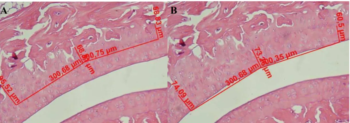 Fig 4. Fotomicrografia da cartilagem articular da tibia distal (H&amp;E) em maior aumento, mostrando o método  de análise da espessura (A) da cartilagem calcificada, medida a partir da interface do osso subcondral até a 