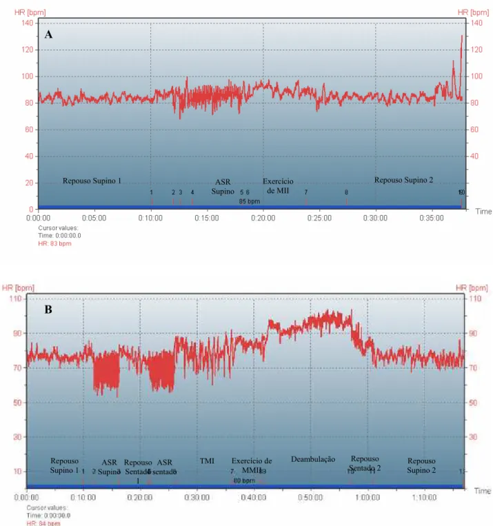 Figura 2: Ilustração da aquisição da FC instantânea obtida a partir da gravação dos iRR pelo  software  do sistema polar, durante a execução da 1ª etapa (A) e da 6º etapa (B) do  procedimento experimental de um dos pacientes estudados (OG)