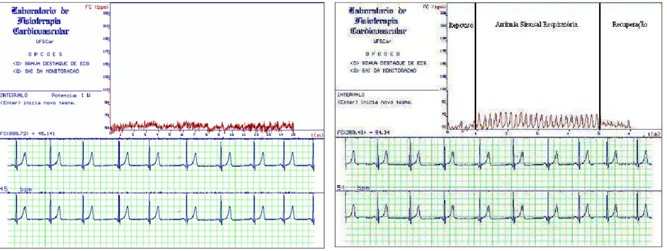 Figura 2.  Ilustração da aquisição dos dados da freqüência cardíaca, batimento a batimento em tempo real, obtida a partir dos  intervalos RR do eletrocardiograma na condição de repouso supino (esquerda) e manobra para acentuar a ASR (direita)  de um dos vo