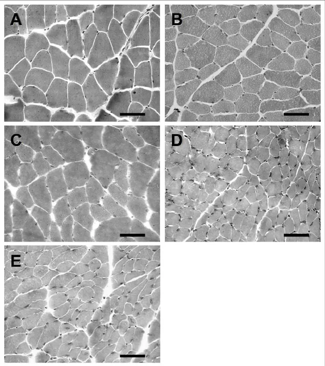 FIGURA 2. Cortes transversais das fibras musculares dos músculos tibial anterior (TA)  corados com azul de toluidina