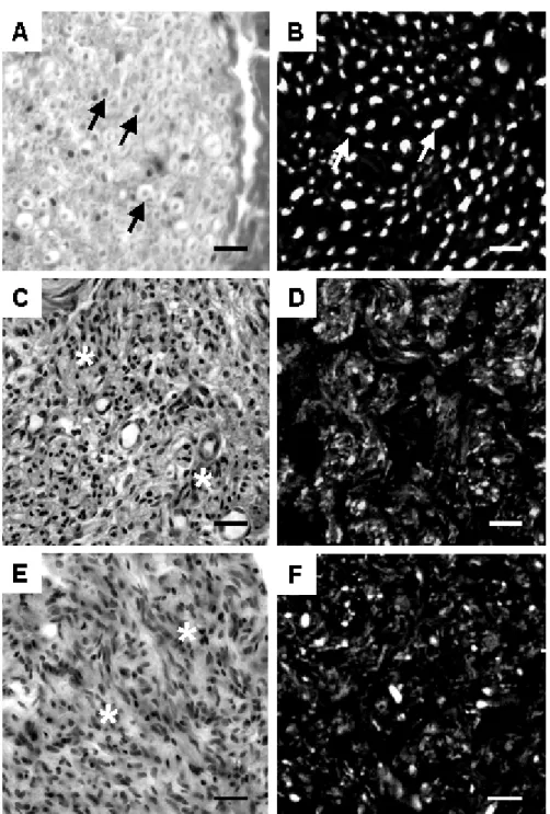 FIGURA 5. Cortes dos nervos ciáticos do controle (A,B), desnervado (C, D) e desnervado  tratado com eletroestimulação (E, F)