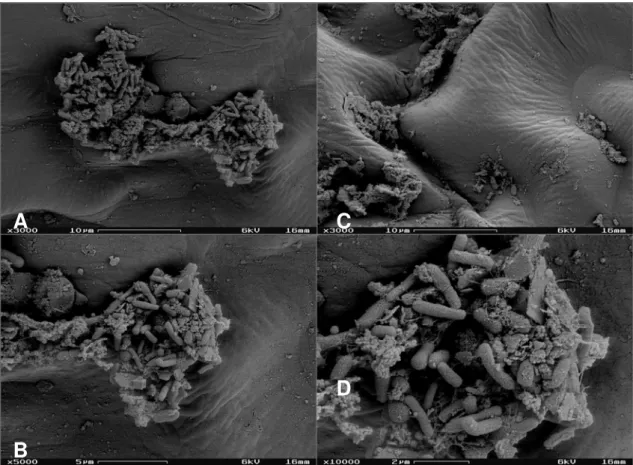 Figura 8 .  Elétron-micrografias de varredura da superfície foliar de alface NL  pertencente ao CO