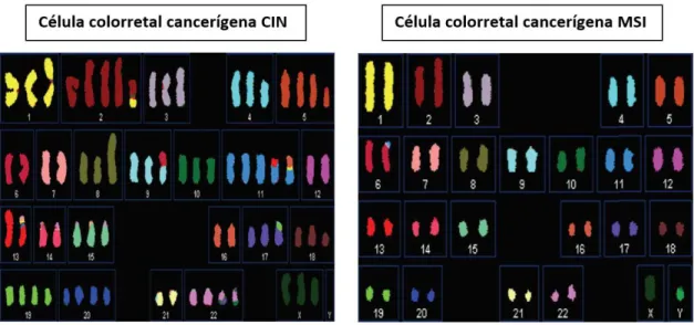 Figura  3.1-  Comparação  de  anormalidades  cromossomais  numéricas  entre  duas  linhagens  celulares  representativas  caracterizadas  por  CIN  (cariótipo  aneuploide)  e  por  MSI  (cariótipo  diploide)