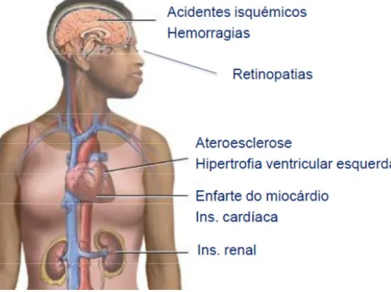 Figura 8 Principais lesões órgão-alvo da HTA 17