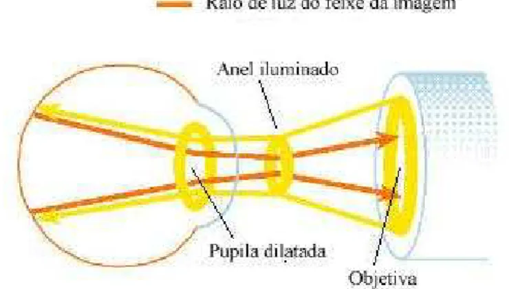 Figura 2.9 - Técnica de iluminação do fundo do olho  [4] . 