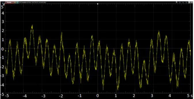 Fig. 24. Sensitivity test: AC motor’s vibration sensing (time domain). 