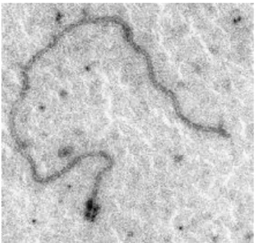 Figura 1.2.1 - Partícula viral de CTV vista ao microscópio eletrónico. (Fonte: Niblett et al., 2000) 