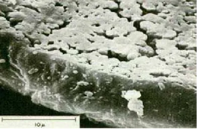 Figura 2.5 – Micrografia de partículas PVC obtida pelo processo de suspensão obtidas  por microscopia eletrônica de varredura [2]