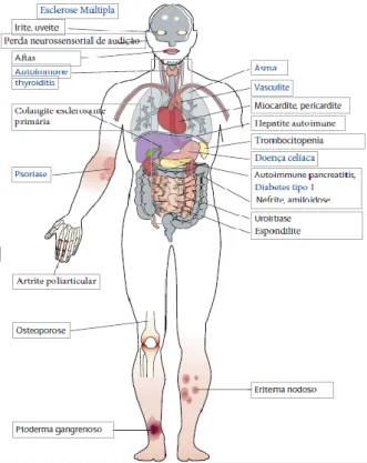 Figura 2. Manifestações extraintestinais da DII [30] 