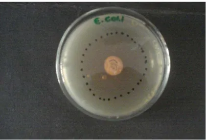 Figura 11: Bioatividade contra E. coli  ATCC 25922.