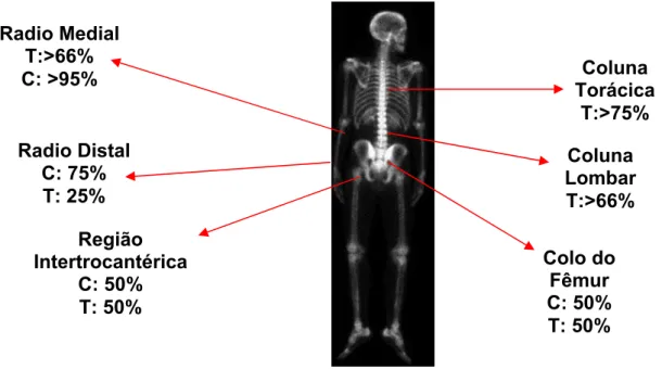 Figura 1: Porcentagem de osso cortical (C) e trabecular (T) em diferentes regiões do esqueleto  (KATER, 2001) 
