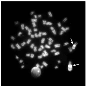 Figura 8. Distribuição cromossômica do sítio de rDNA 18S em Imparfinis schubarti. 