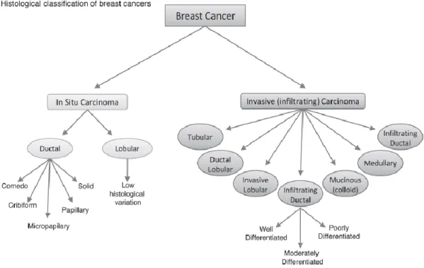 Figure 1.2.1.1  Histological  classification  of  breast  cancer. Breast  cancer  can  be  catalogued  into  different  subtypes,  according  to  histological  features  and  growth  patterns