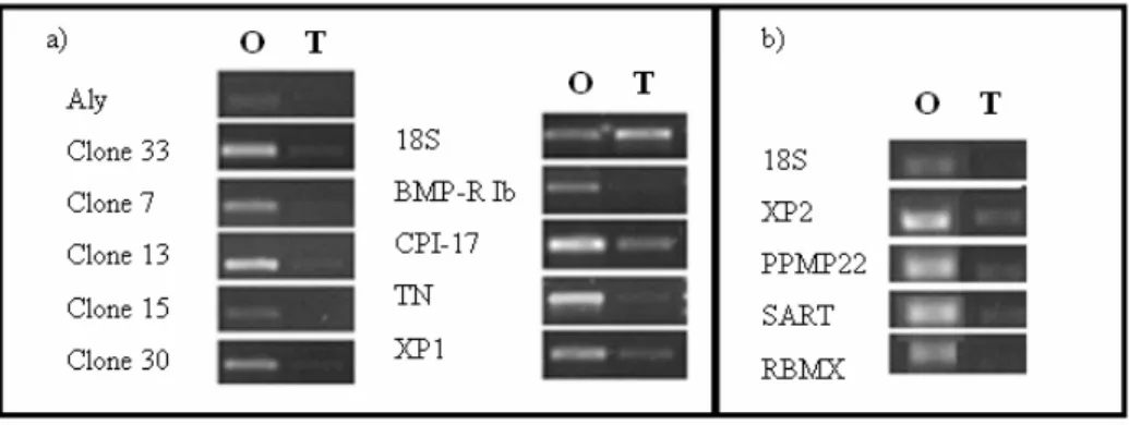Fig. 9 – Each gene was tested for sexual dimorphism, using cDNA from testes and ovary, in 2 different RT-PCRs (a)  and (b)