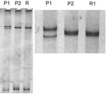 Fig. 2. Single-stranded conformation patterns of the cloned coat protein gene from isolates P1, P2 and R1.