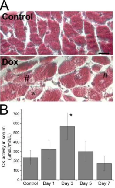 Figure 1. Myocardial lesion induced by doxorubicin treatment in our rat model. Panel A shows  micrographs of myocardium sections from Control and doxorubicin-treated rats (Dox group, day 5  after injection) stained by Masson trichrome staining procedure