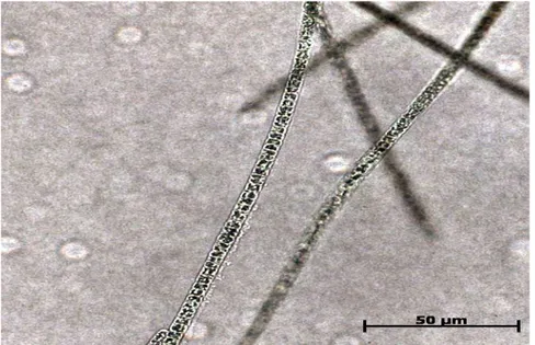 Figura 5. Microfotografia de Planktothrix agardhii no primeiro dia de cultura para observação de formação  dos tubos de polissacarídeo 