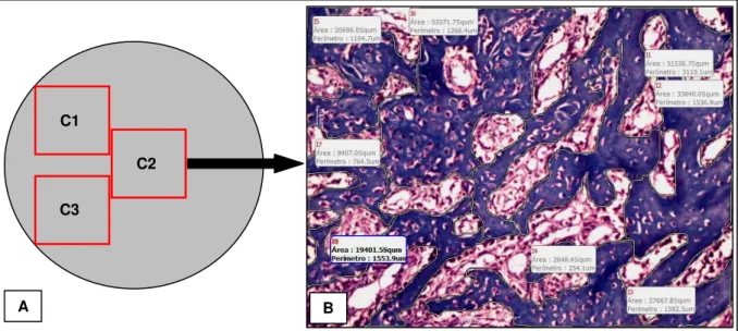 Figura 5. Morfometria da área de osso neoformado: (A) desenho ilustrativo da padronização  dos campos selecionados na análise morfométrica; (B) fotomicrografia representativa do  campo 2 (C2) de um defeito ósseo do grupo tratado com laser 60J/cm²
