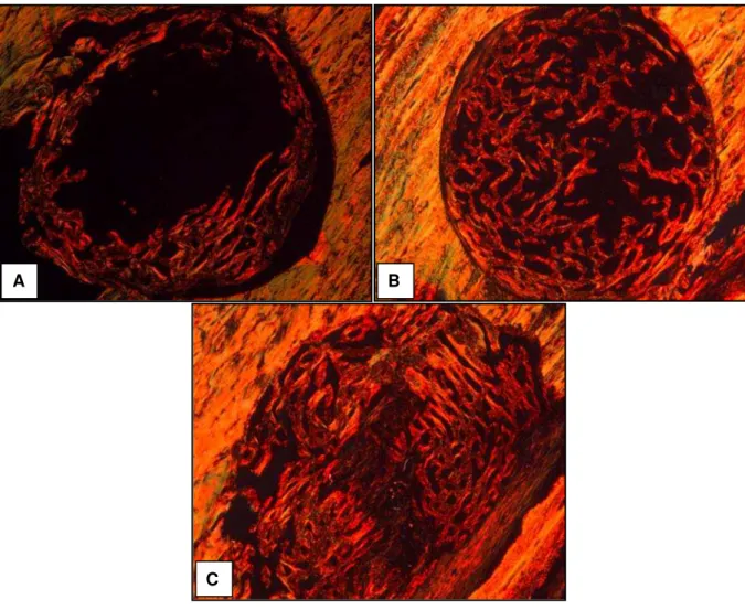 Figura 9. Fotomicrografias de defeitos ósseos, corados com Picrosirius-red. No grupo  controle (A) o brilho de birrefringência é moderado e as fibras colágenas localizam-se  circunjacentes à lesão