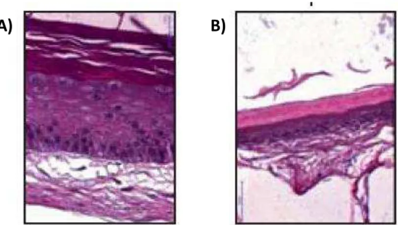 Figura 6. Fragmentos de pele de rato corados com HE (60x). A) Pele normal. B) Pele  atrofiada  após  aplicação  tópica  de  clobetasol  por  12  dias