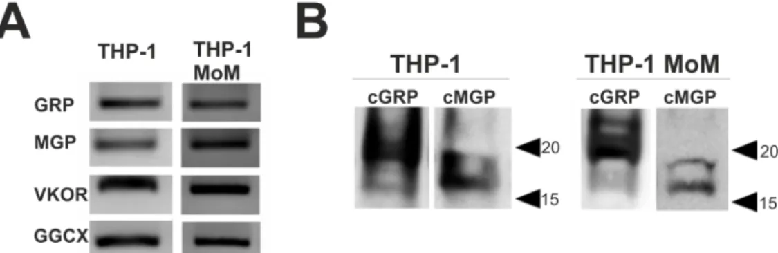Fig 2. γ-carboxylated GRP and MGP are produced in THP-1 cell line. THP-1 and THP-1 MoM differentiated with 25 ng/ml of PMA during 48h were cultured in control conditions and harvested for RNA and protein extraction.
