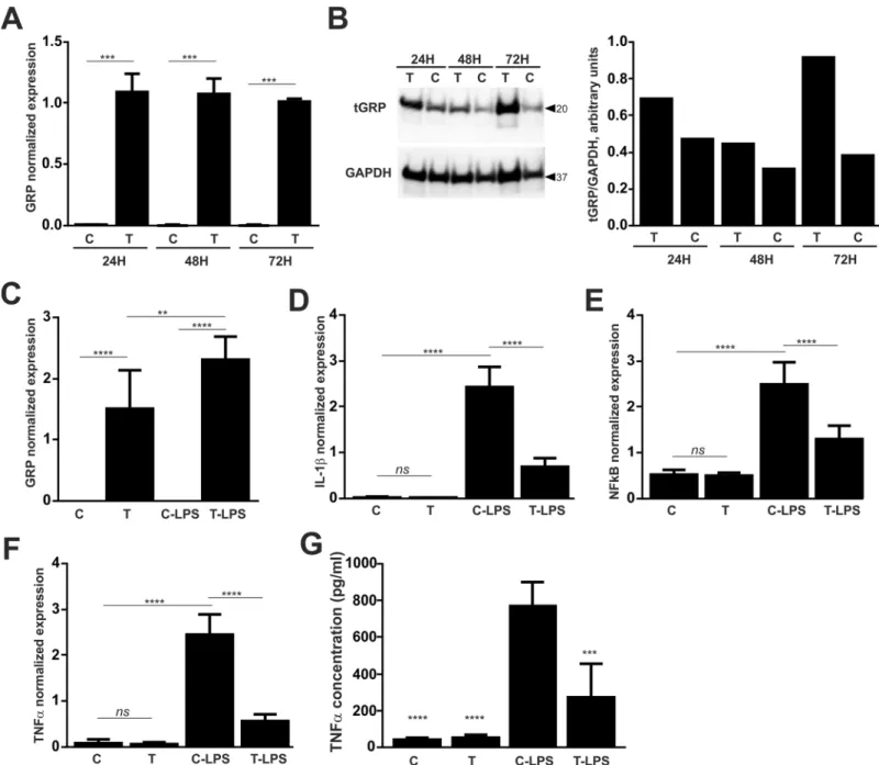 Fig 7. Overexpression of GRP in THP-1 cells rescues LPS induced inflammation. THP-1 cells were transiently transfected with GRP mRNA during 24, 48 and 72 h, and GRP overexpression was evaluated by measuring levels of GRP mRNA (A) and protein production (B)