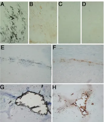 Figure 6. GRP is highly accumulated in the human vascular system at sites of pathological calcification of human arteries from both CDK patients (A–D) and postmortem samples (pM) (E–H)