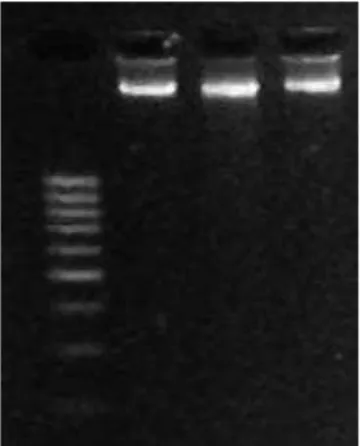 Figura 6: Fotografia mostrando as bandas do DNA genômico extraído em gel de agarose 1% 
