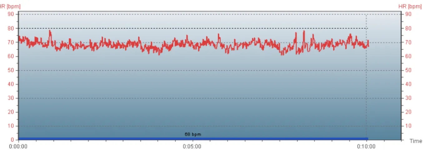 Figura 3. Ilustração da tela de aquisição da freqüência cardíaca instantânea, pelo sistema de  telemetria Polar durante a coleta em repouso na posição supina (10 minutos).