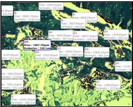 FIGURA 5: Fotomicrografia com a demarcação da área de neoformação  óssea. A cor azul indica a área de tecido ósseo neoformado