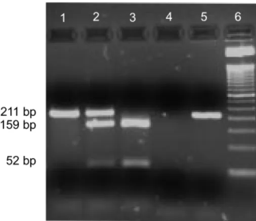 Figure 1. Analysis of AluI polymorphism at the bGH gene: Electrophoretic patterns of the three genotypes separated on a 3.5 p.100 agarose gel